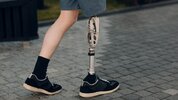 020719-prosthetic-leg-generic.jpg