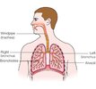 MACD024_Lungs-respiratory-system.jpeg