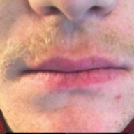 Attempted Moustache