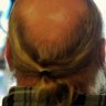 The Receding Pony