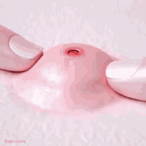 pimple-pop.gif